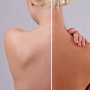 Bronzage MARC INBANE